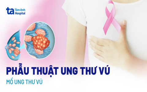 Khi đề về 85, ngày mai đánh con gì? Cách chọn số chuẩn xác